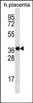 SLC38A8 antibody