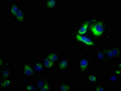 SLC39A10 Antibody