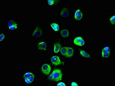 SLC39A11 antibody