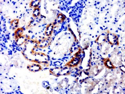SLC39A11 Rabbit Polyclonal Antibody
