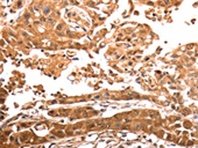 SLC39A6 antibody