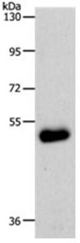 SLC39A6 Antibody