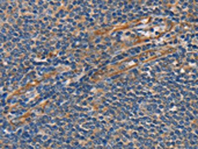 SLC39A7 antibody