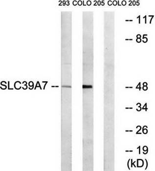 SLC39A7 antibody