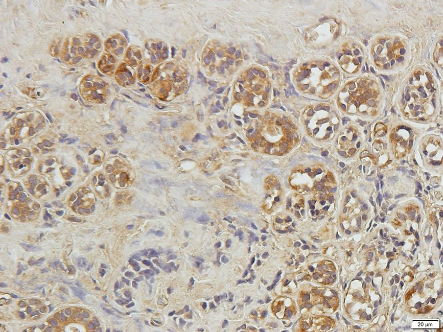 SLC40A1 Rabbit Polyclonal Antibody