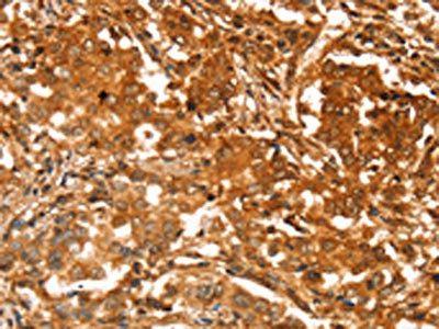 SLC41A2 Antibody