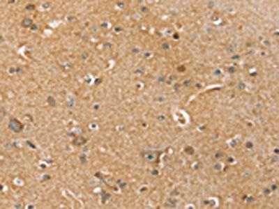 SLC41A2 Antibody