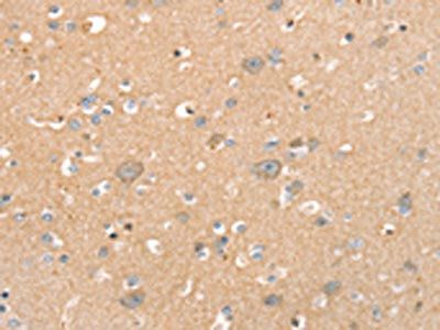 SLC41A2 Antibody