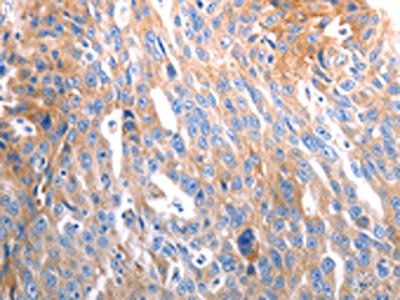 SLC44A1 Antibody