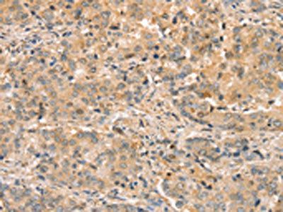 SLC44A2 Antibody