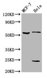 SLC45A2 antibody