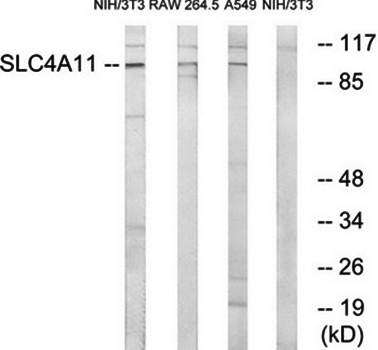 SLC4A11 antibody