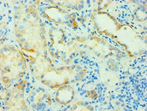 SLC4A2 Antibody