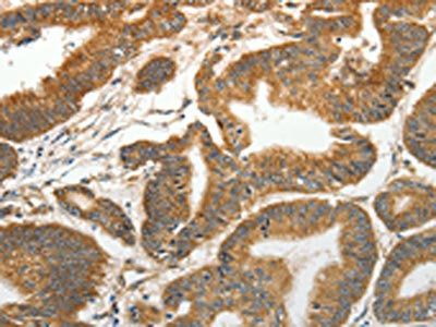 SLC4A4 Antibody