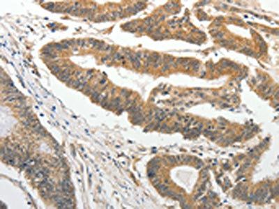 SLC4A4 Antibody