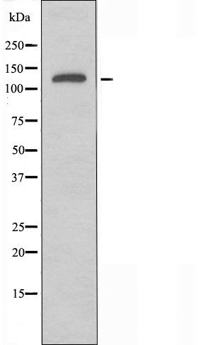 SLC4A8/10 antibody