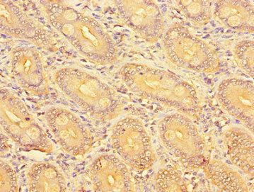SLC51A Antibody