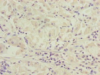 SLC52A1 Antibody