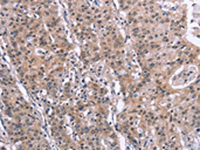 SLC52A1 antibody