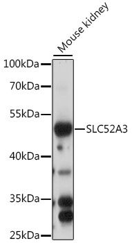 SLC52A3 antibody