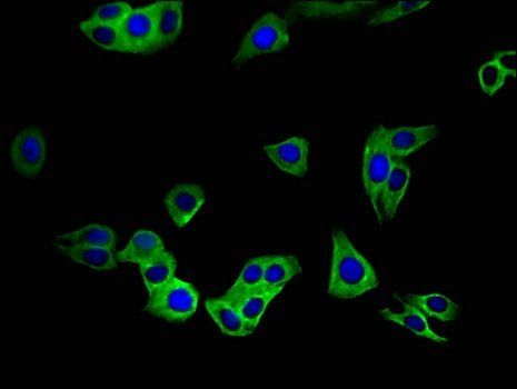 SLC52A3 Antibody