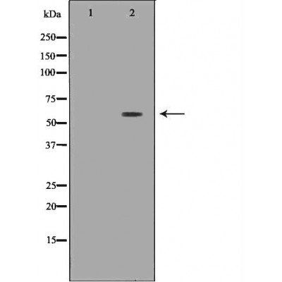 SLC5A1 antibody