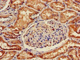 SLC5A1 Antibody