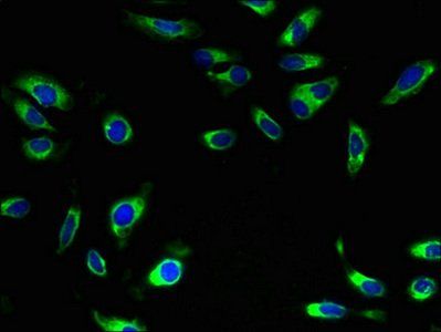 SLC5A10 Antibody