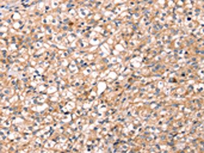 SLC5A11 Antibody