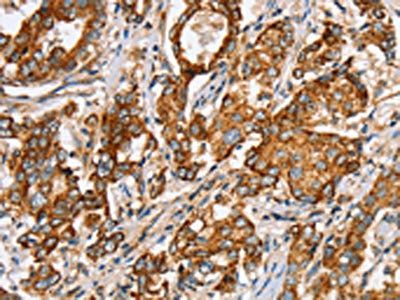 SLC5A11 antibody