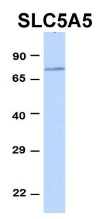 SLC5A5 antibody