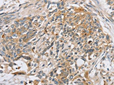 SLC5A6 Antibody
