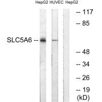 SLC5A6 antibody