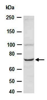 SLC5A7 (N) Antibody, Rabbit Polyclonal