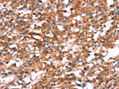 SLC6A1 Antibody