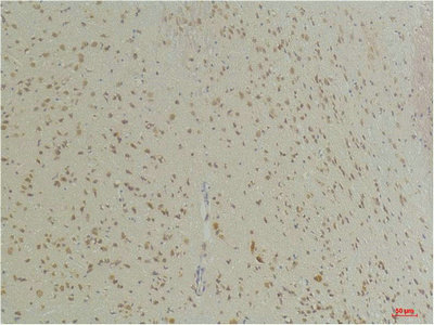 SLC6A1 Antibody