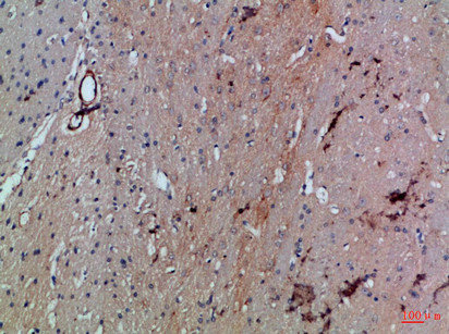 SLC6A1 Antibody