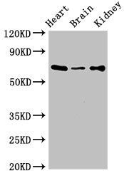 SLC6A13 antibody