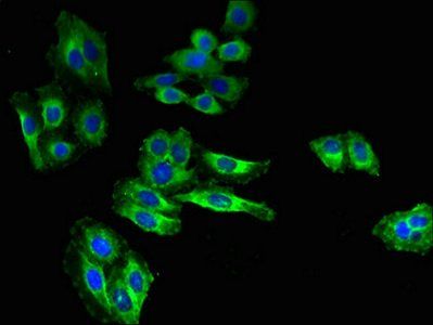 SLC6A15 Antibody