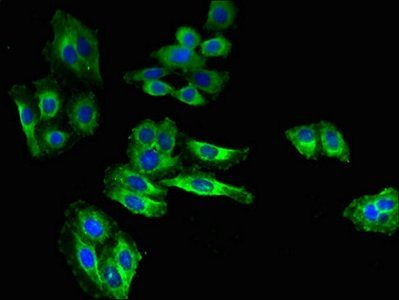 SLC6A15 antibody