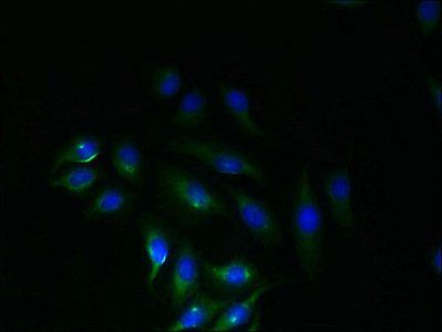 SLC6A16 antibody