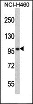 SLC6A17 antibody