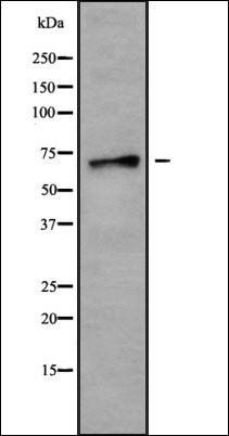 SLC6A18 antibody