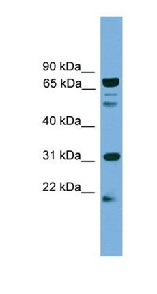 SLC6A3 antibody