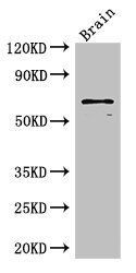 SLC6A3 Antibody