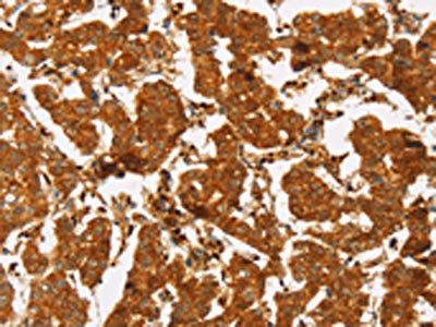 SLC6A3 Antibody