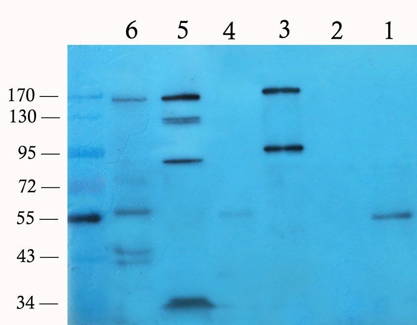 SLC6A5 Rabbit Polyclonal Antibody