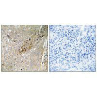 SLC6A6 Antibody