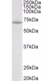 Goat anti-Creatine transporter 1 / SLC6A8 Antibody