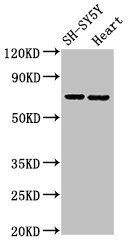 SLC6A8 Antibody
